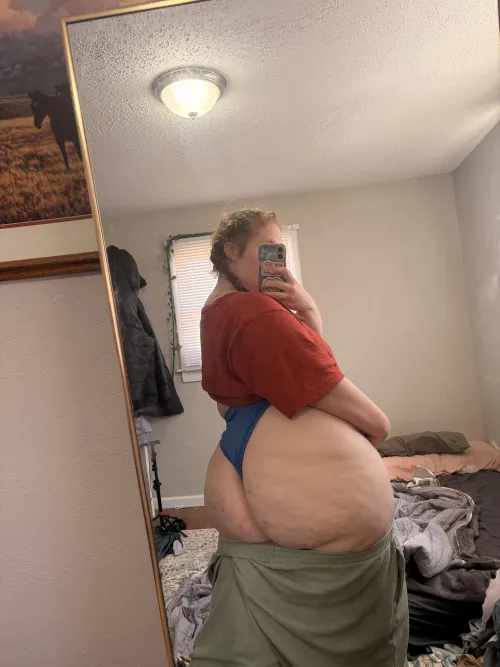 I put moderate, but would you call this extreme, or moderate, or light cellulite, I’m curious what you guys think