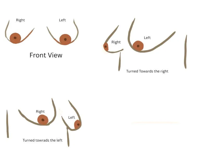 I Can't Tell if My Boobs Are Constricted