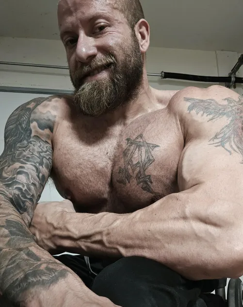 (34M Spina Bifida, Para.)