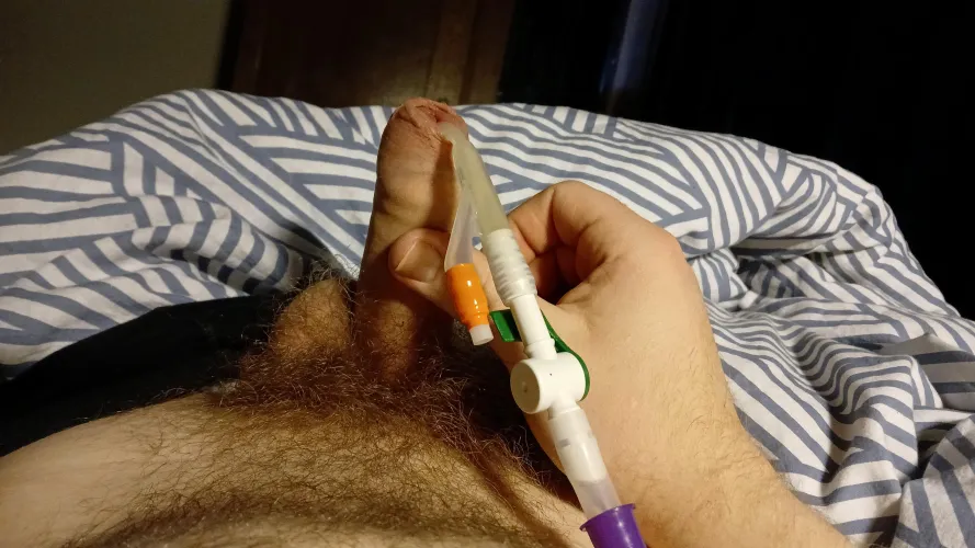 Goodmorning waking up whit a bag full to 1400ml of my pee and a stiff one 