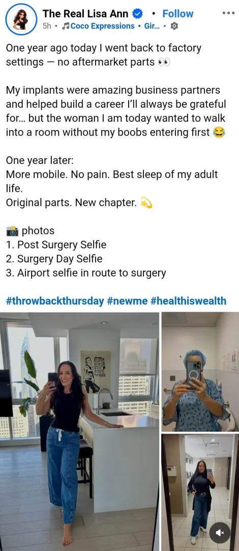 Lisa Ann before and after