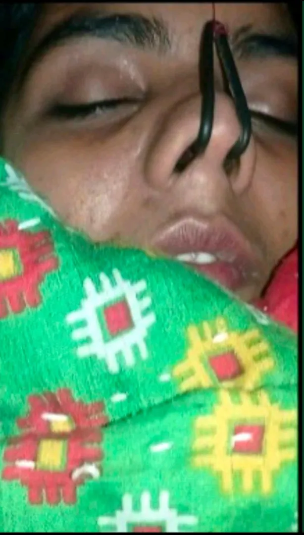 Sleeping girl nose hook