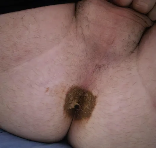 Hey guys, m28 here, I dont really know why this happened but I dodnt know where to turn haha, pls read post