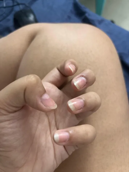 how to stop nail biting and cuticle picking?