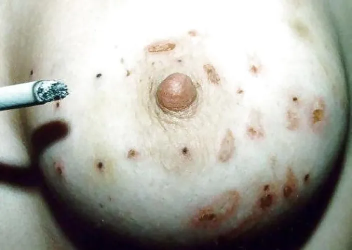 Who needs an ashtray when you have pair of tits