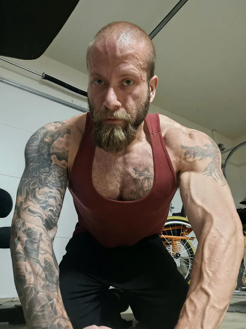 (34m. Spina Bifida, para.)