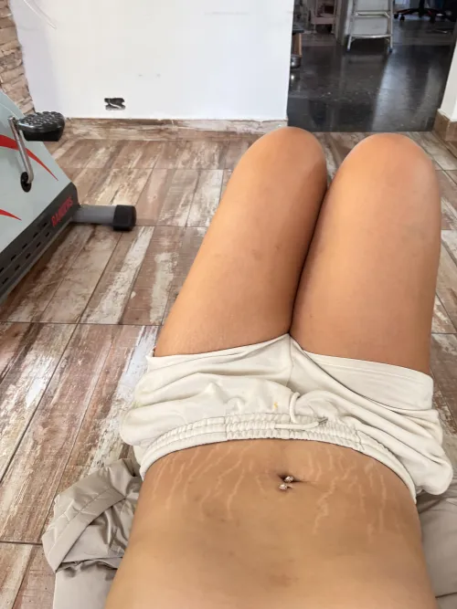 Exercise with my lovely stretch marks