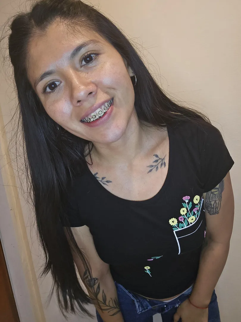 Do you like my braces?