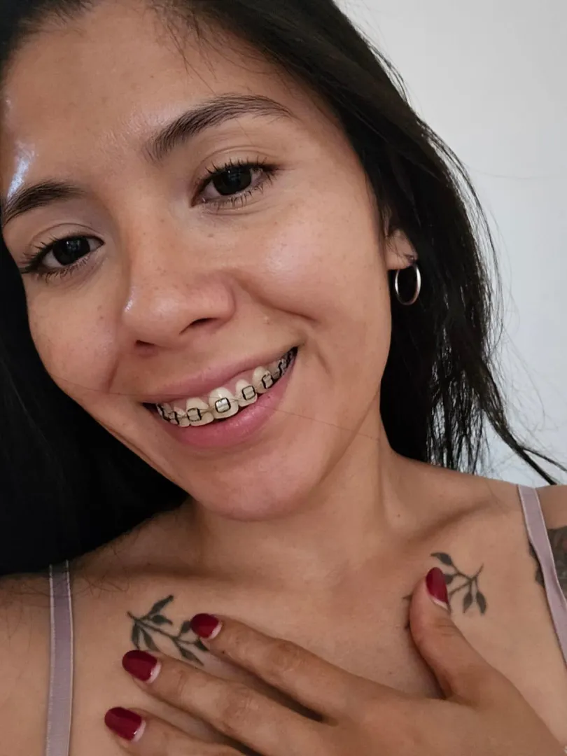 Happy Thursday! Kissing with braces is so nice!