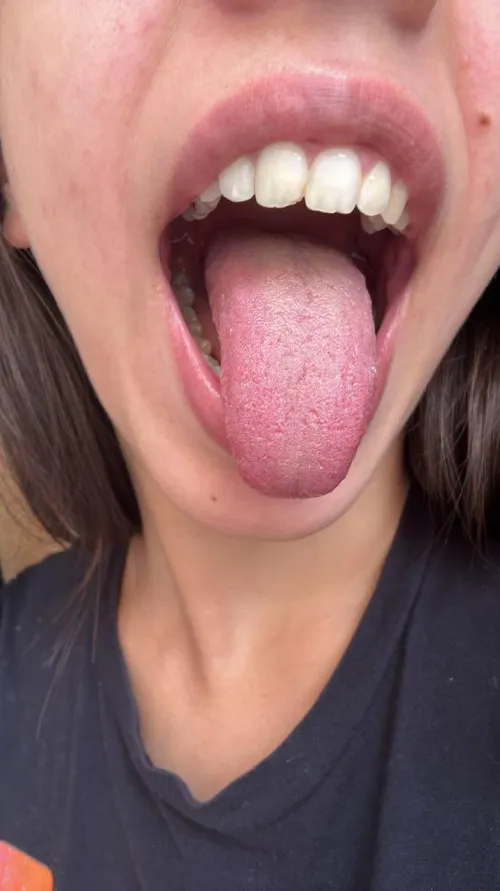 Wide open and ready for you