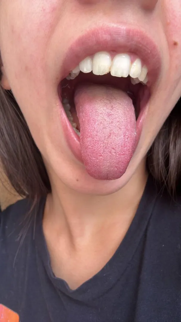 Wide open and ready for you