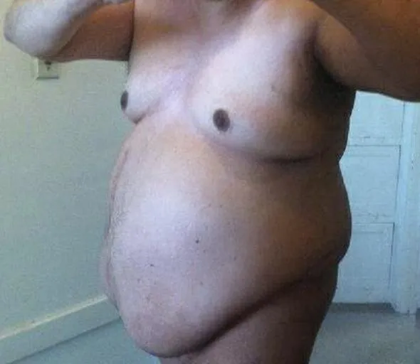 62 [M4F] #San Francisco - Are you a WOMAN seeking humiliation & degradation? If so, then this Fat, Ugly, Old Pervert is just what the doctor ordered! NOTE: I’M LOOKING FOR WOMEN IN THE SAN FRANCISCO BAY AREA ONLY FOR REAL-TIME PLAY. I’M NOT INTER