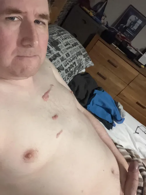 Good morning M43 Muscular Dystrophy