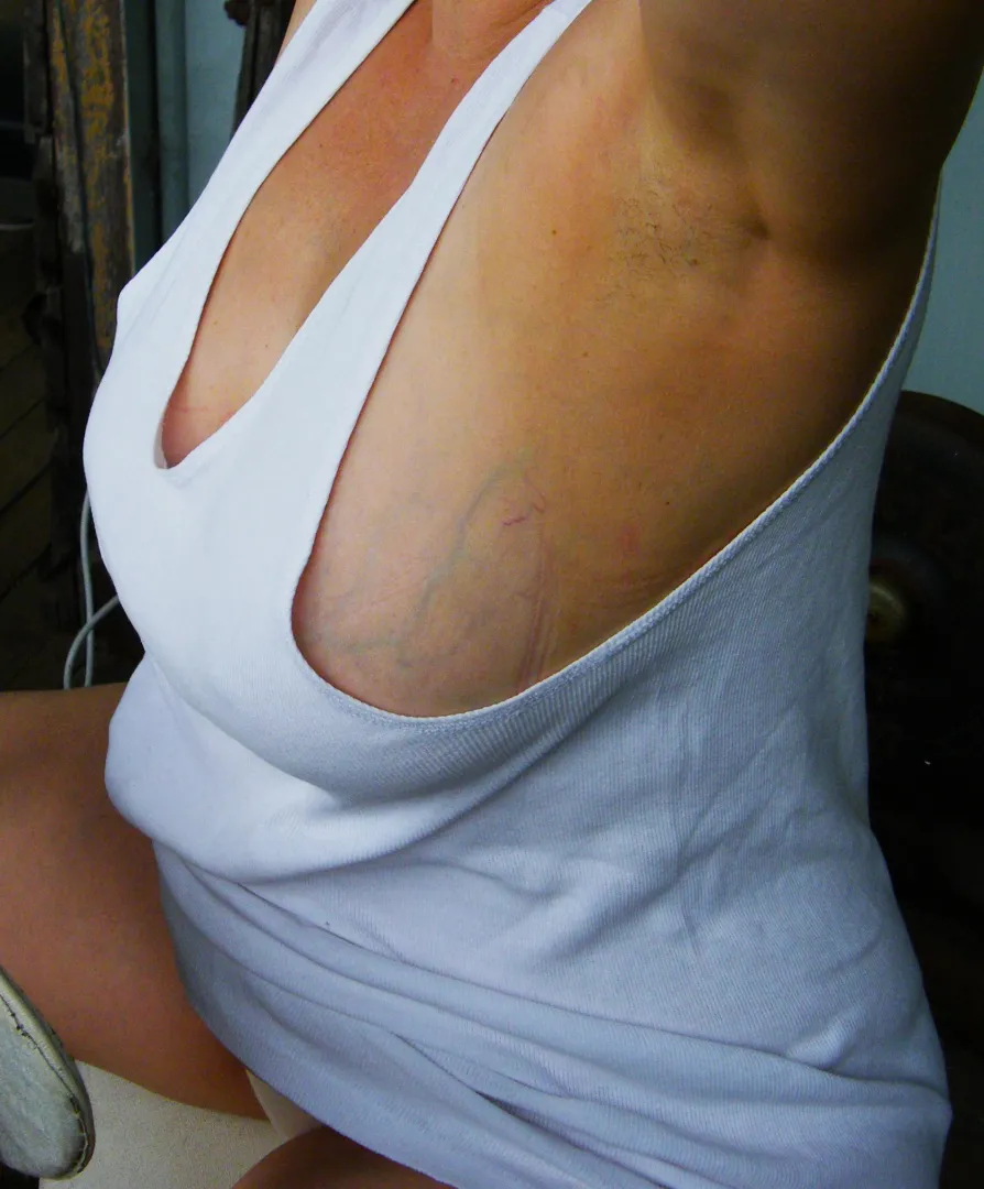 Big side on display.