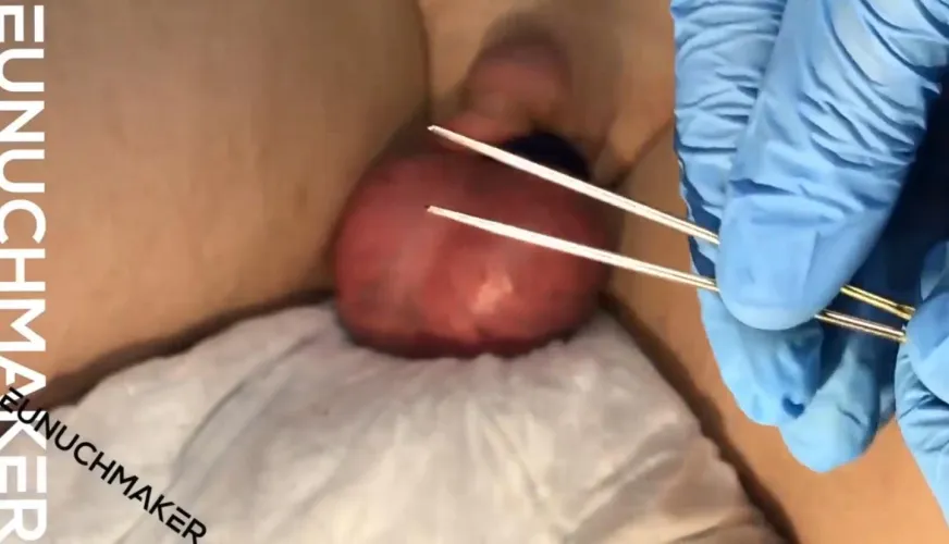 Are massive needles significantly more painful to stir with than tiny needles?