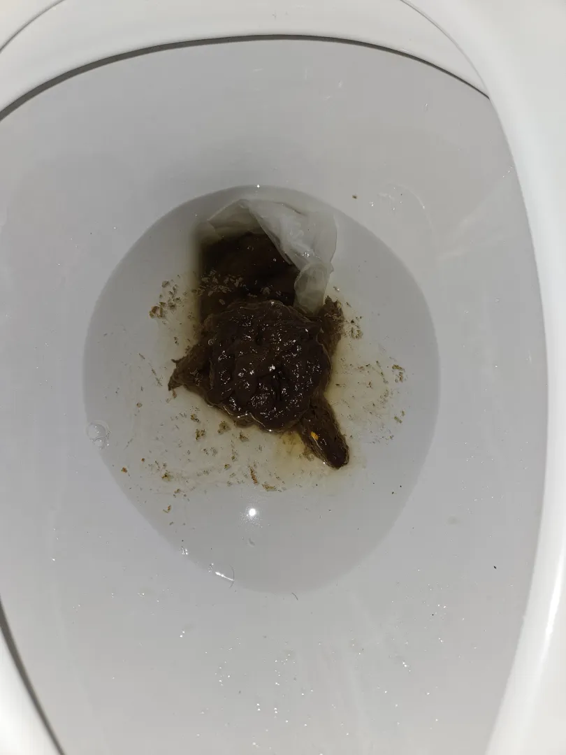 Diarrhea at work