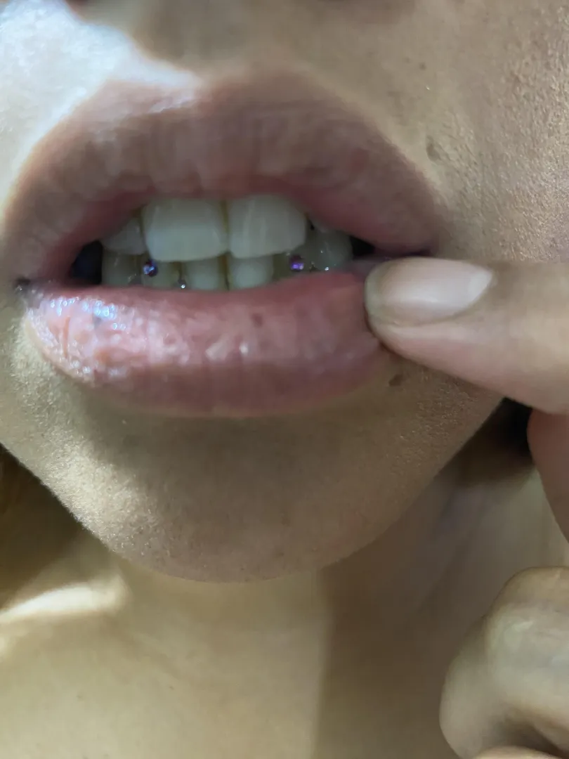 Full lips always lubricated