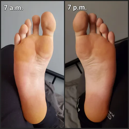 My feet, in the early morning and at the end of the day. See a difference?