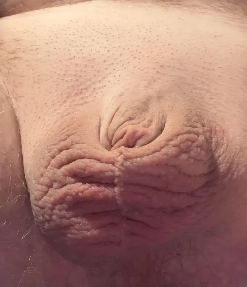 Ever seen a smaller clit?