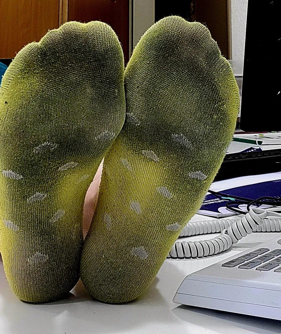 [F] Worn too long… and it shows 