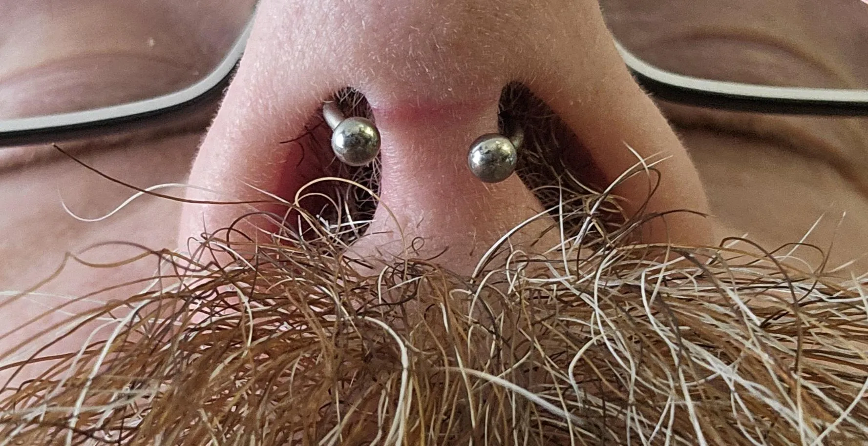 Freshly pierced, normal to be like that?