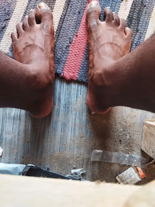 Too much veins? (19M)