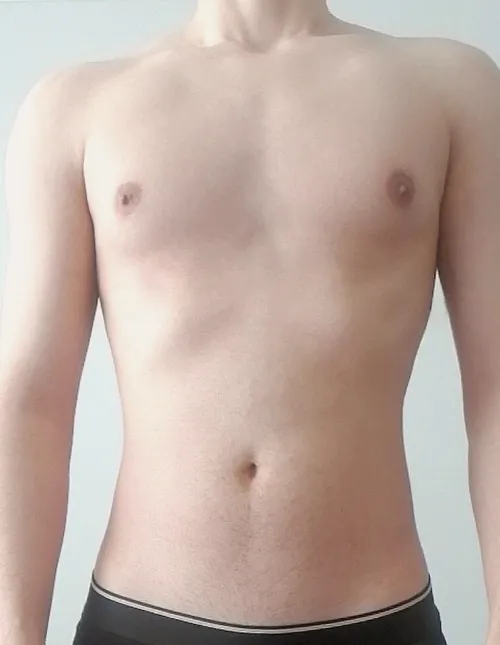 18 how would you try this delicacy?