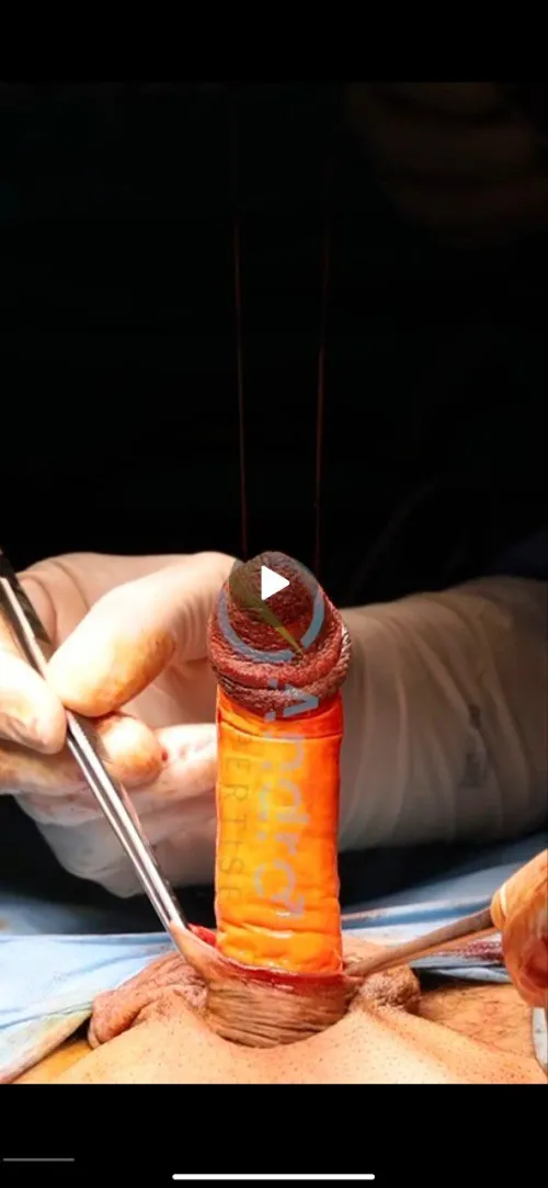 deglovin (full vids my tele Farour33