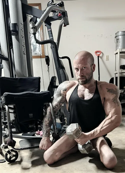 (34M. Spina bifida, para.)