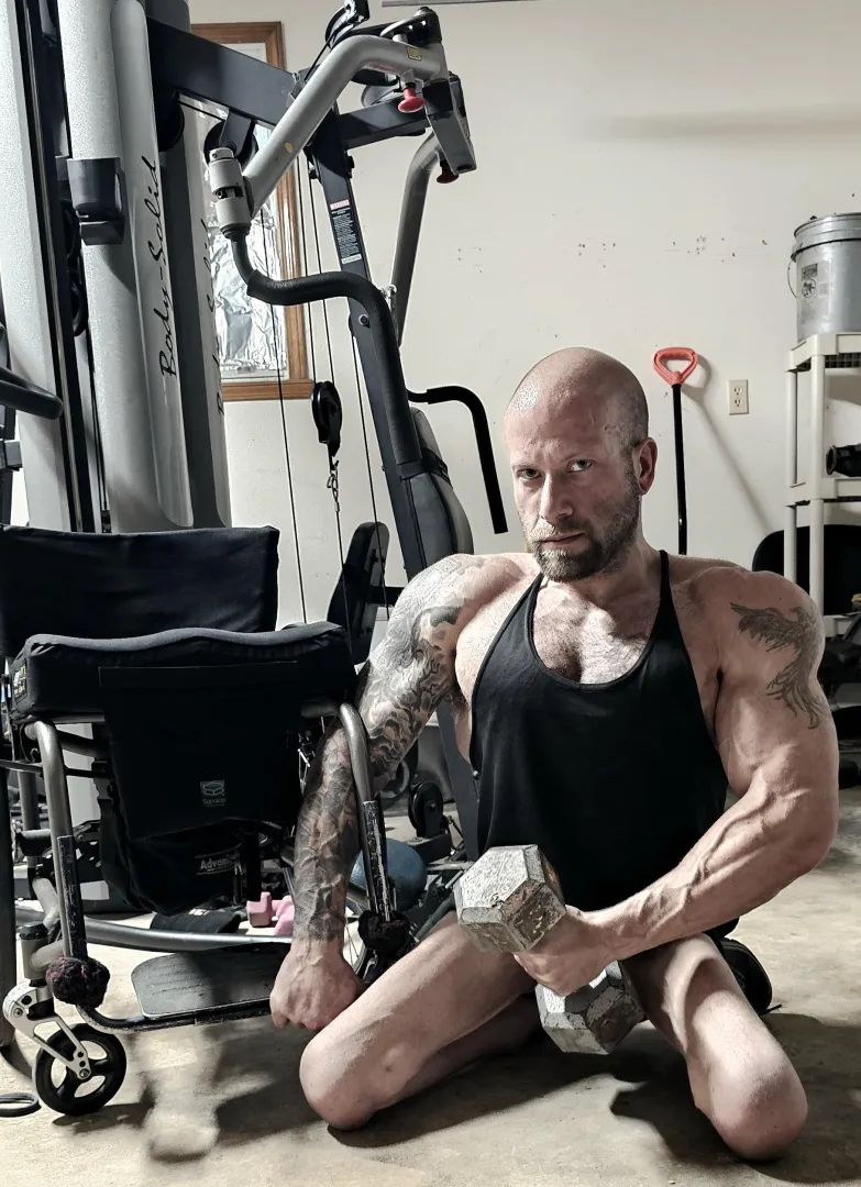 (34M. Spina bifida, para.)