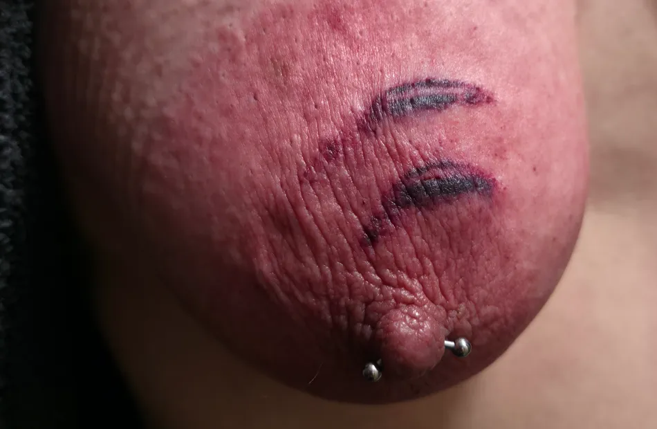 A Beautiful Close-Up of the Aftermath