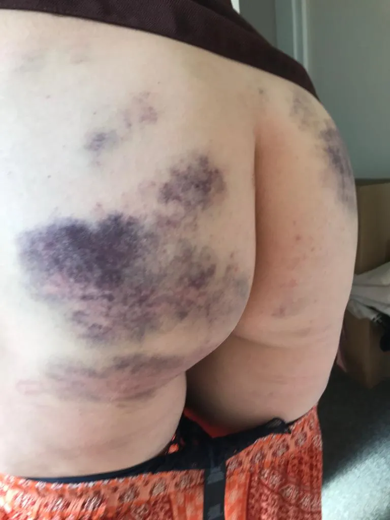 Aftermath, she's lost without her marks.