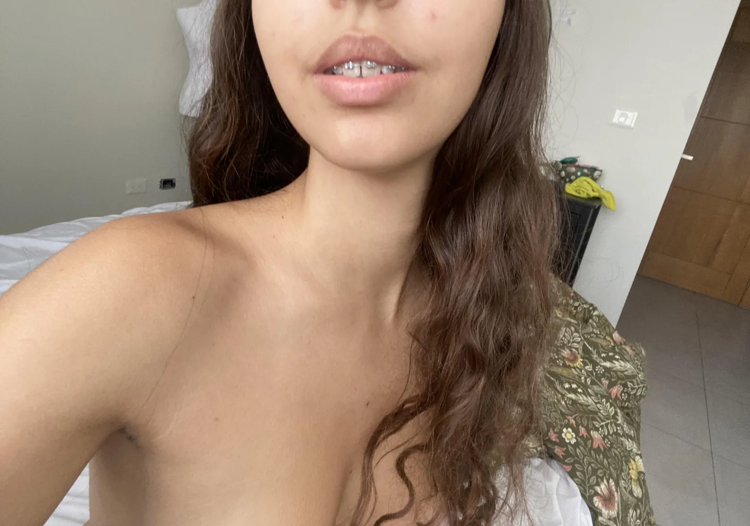 Come get a taste of these braces