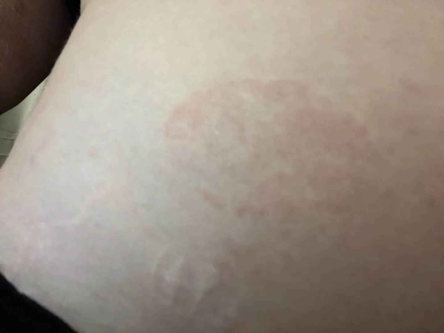 Could this be an allergic reaction, ringworm, or is it something else?