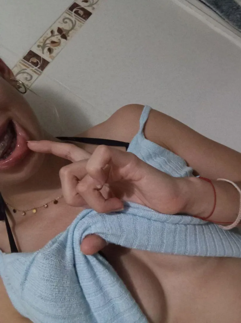 Hope you like my braces