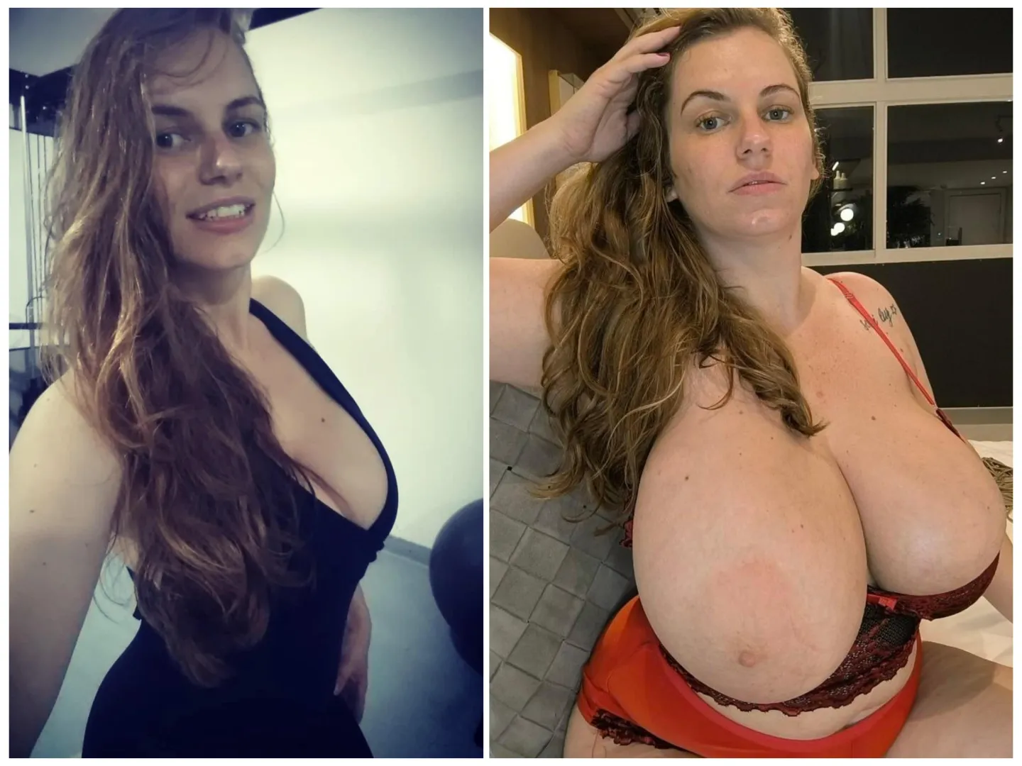 Incredible breast growth