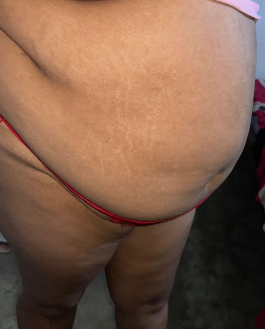 Mis rallas están creciendo oww 