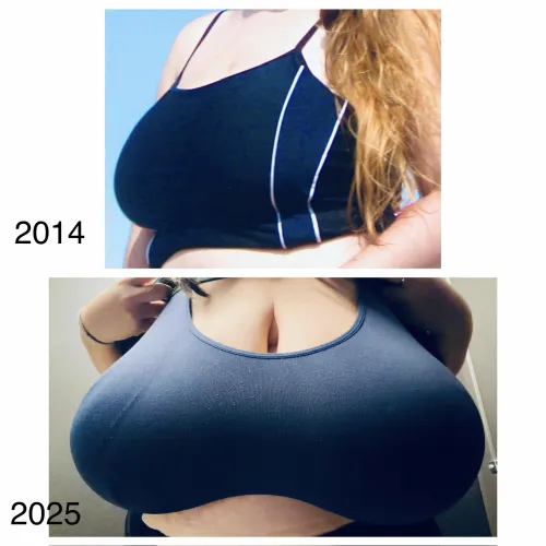 My breasts in blue, then vs now 