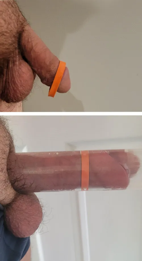 (31m)Before and after