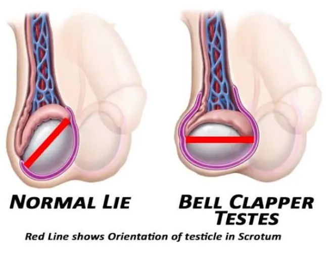 Balls changing position