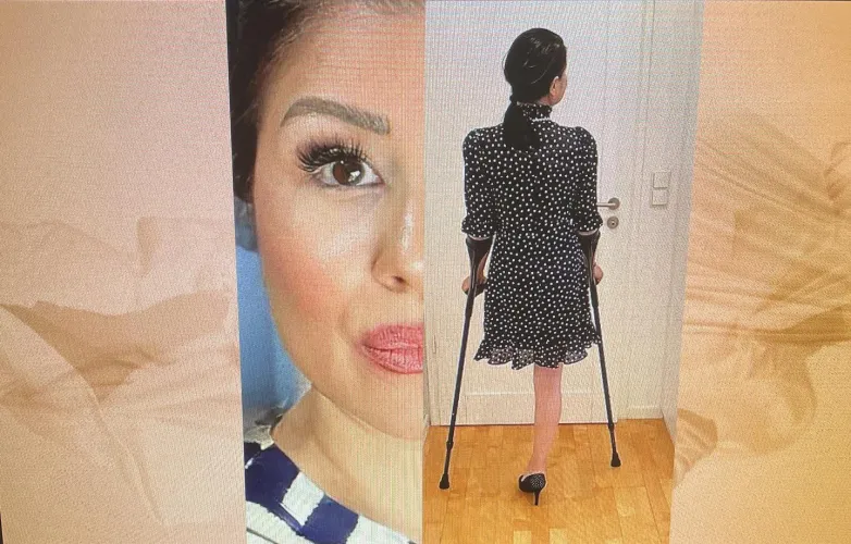 Hi do you know Farina? a dream Amputeelady, you can visit my web amputeelady.de and write me to kontakt@amputeelady .de