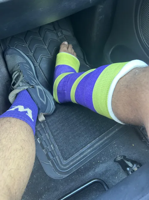 Hiking boots and a cast because of a broken ankle…free toes m22(at time of pic)