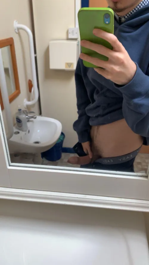 My foreskin is so tight around the head 