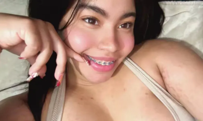 Should I get nails to match my braces?