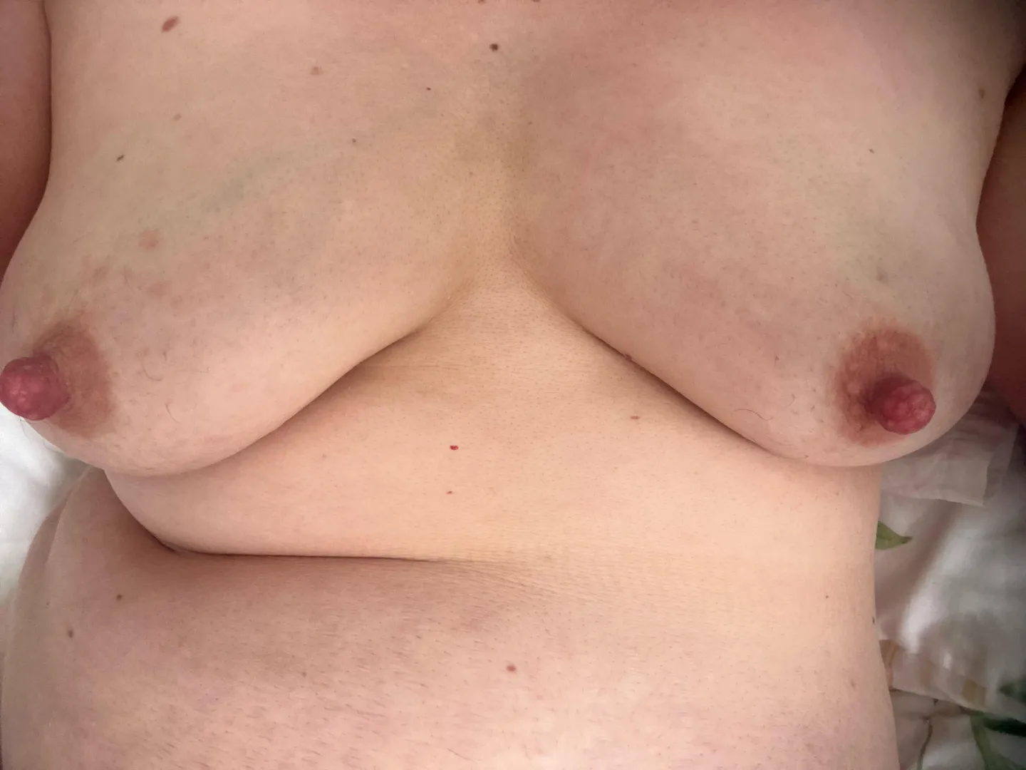 Day 8. Feeling firmer and milk coming through