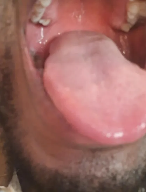 29M #zimbabwe - need a female to drop a huge warm load of poop down my throat