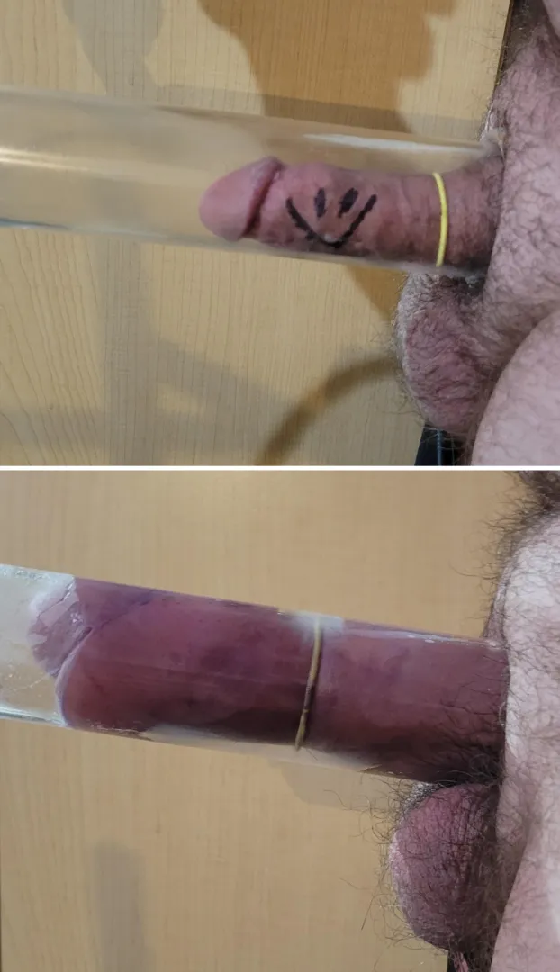 45 minutes into the pump