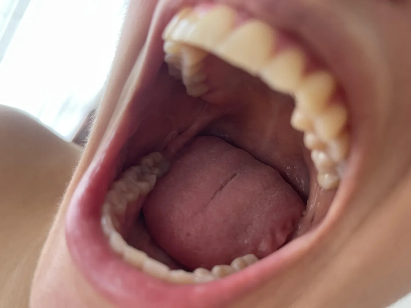 I know you're eager for me to devour you and let my stomach acid dissolve you , right {?}