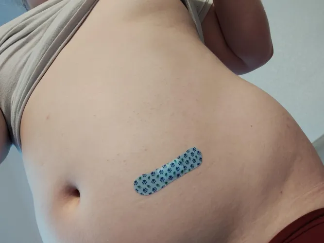 I started injections today 