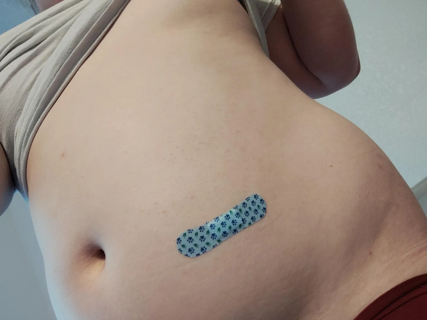 I started injections today 